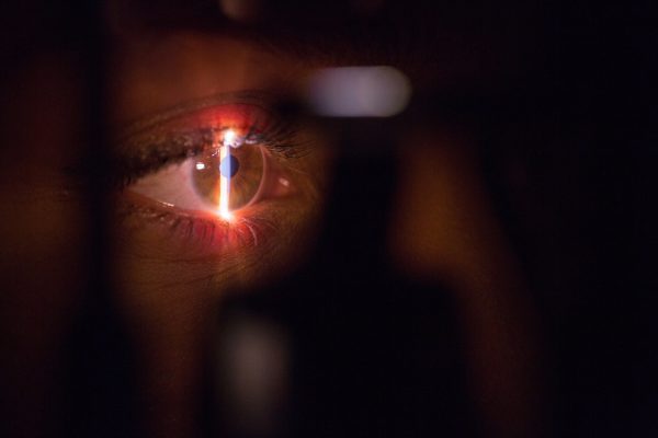 Caminhos abertos e fechados a laser