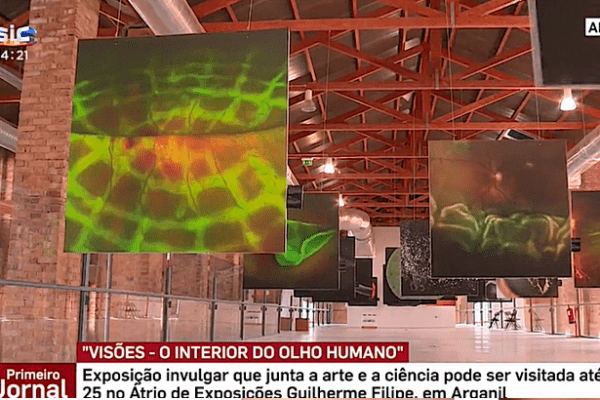 Exposição mostra o interior do olho humano – SIC – Primeiro Jornal
